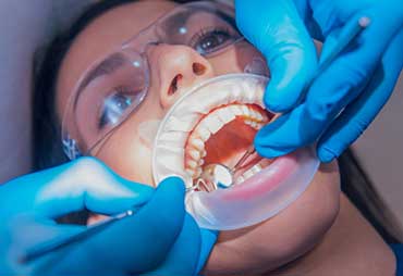 Tratamiento de Endodoncias en Expert Dental - Clínica de Especialidades Dentales en CDMX y Chilpancingo